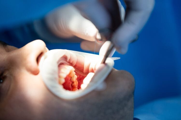 علاج الأسنان العام في أفضل عيادة أسنان في عمان